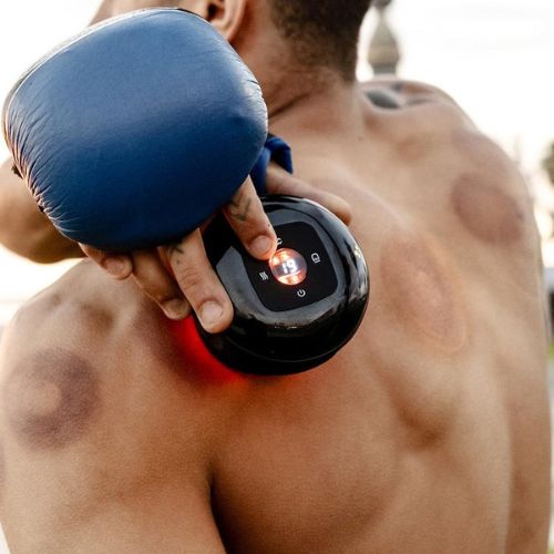 Cuppio™ | Kit de Massage à Aspiration Intelligente